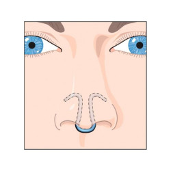 DILATATEUR NASAL CLIP AIR