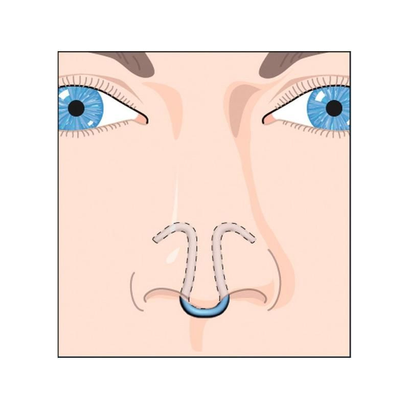 DILATATEUR NASAL CLIP AIR