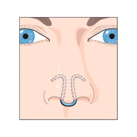 DILATATEUR NASAL CLIP AIR